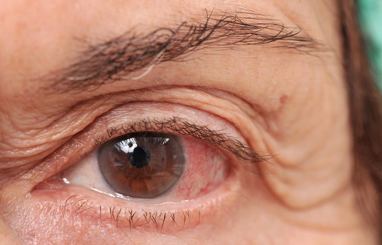 Diyabetik Retinopati Tedavisi